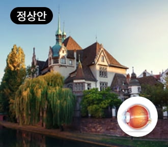 정상안